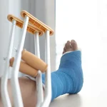 Kondisi Fraktur Atau Patah Tulang Karena Sebuah Insiden