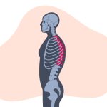Kelainan Pada Tulang Seseorang Yang Di Sebut Skoliosis