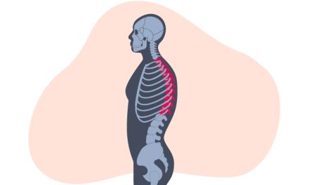 Kelainan Pada Tulang Seseorang Yang Di Sebut Skoliosis