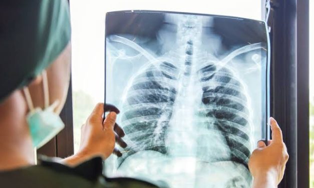 Pemeriksaan Medis Rontgen Untuk Melihat Bagian Dalam