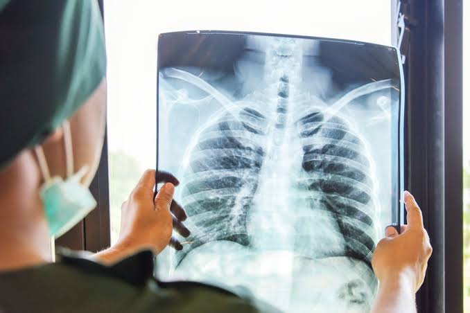 Pemeriksaan Medis Rontgen Untuk Melihat Bagian Dalam